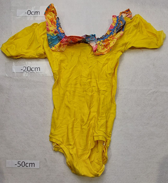 YELLOW LEOTARD WITH DETAIL
